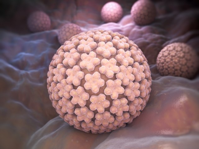 Ljudski papiloma-virusi i rak prostate? Da, uzroèno-posledièna veza